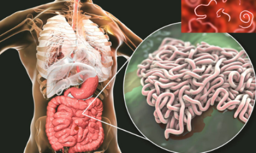 Vermes no Corpo Humano:Riscos e Tratamento.